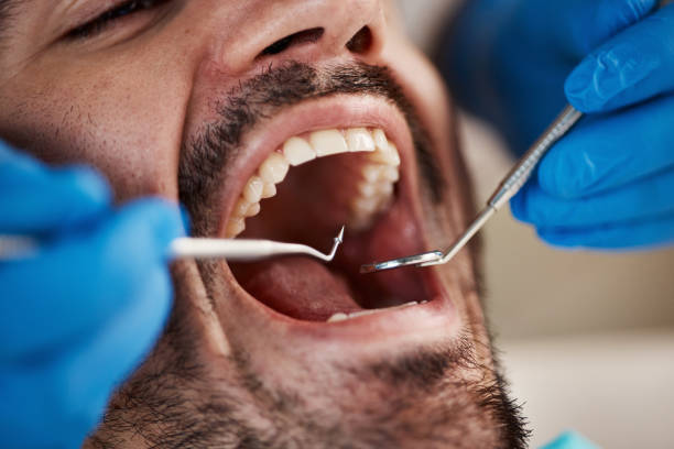 Best Urgent Tooth Repair  in Columbia, PA